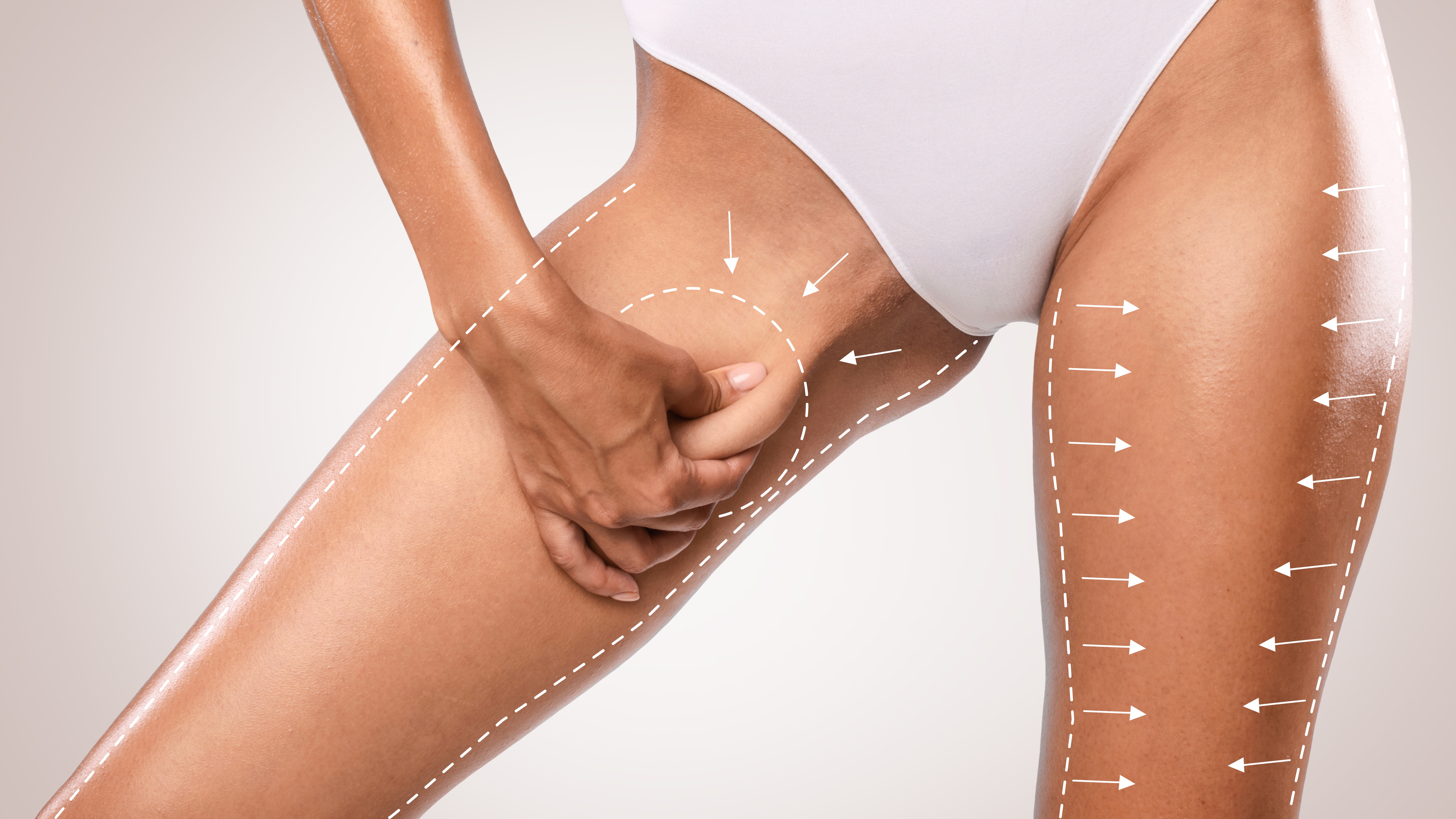 Lipo 360