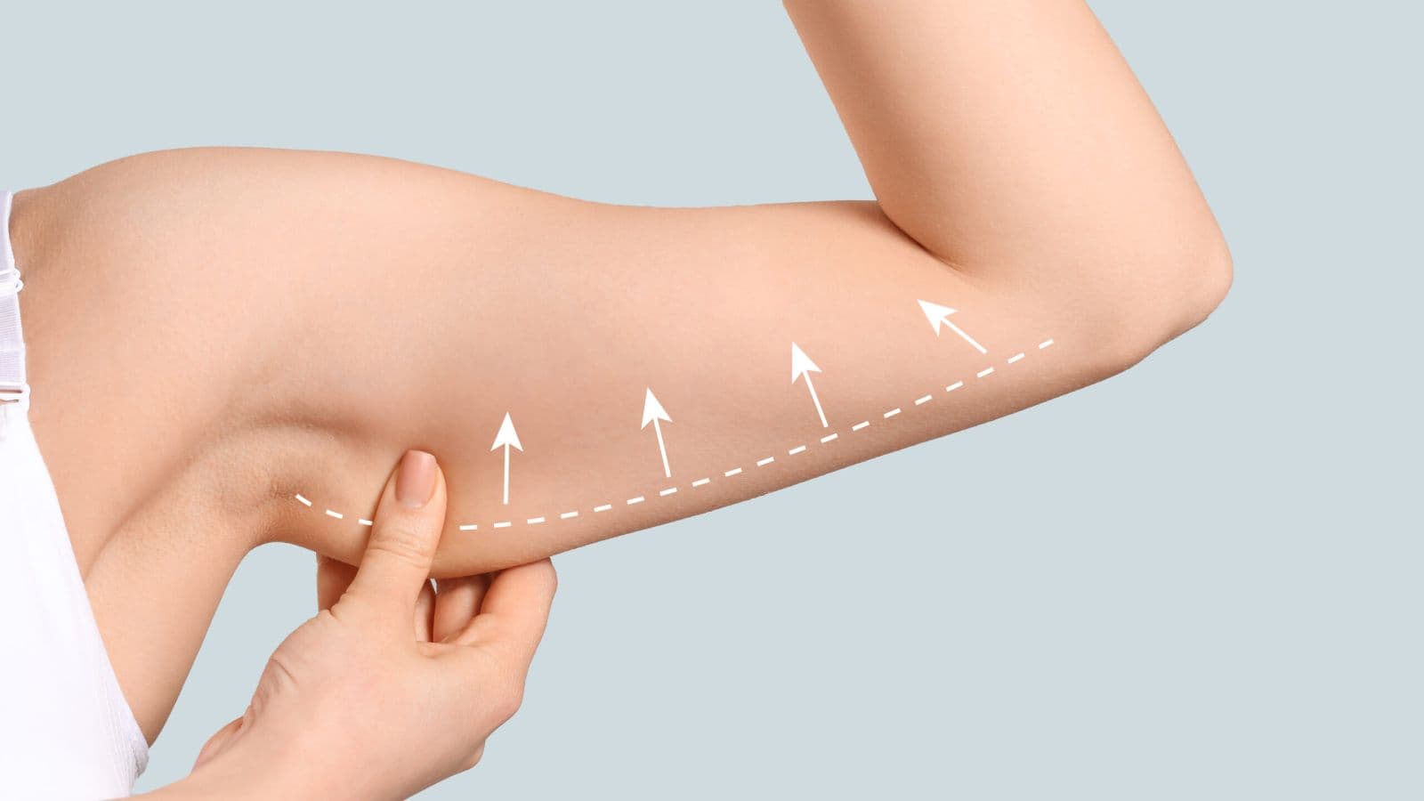 Arm Lift | FK Clinic