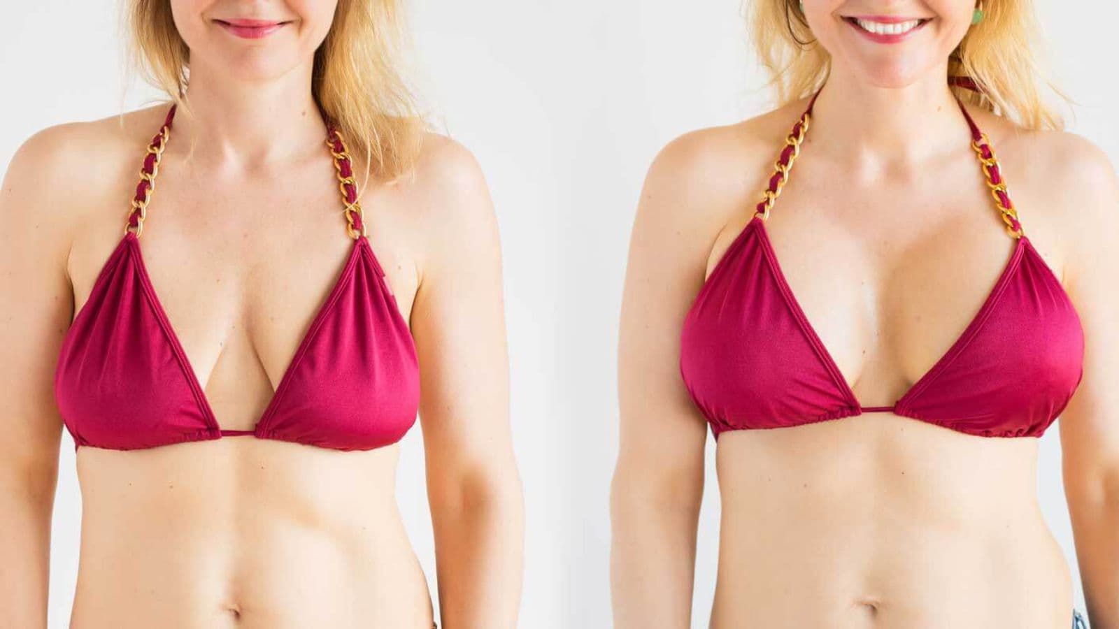 Breast Augmentation | FK Clinic