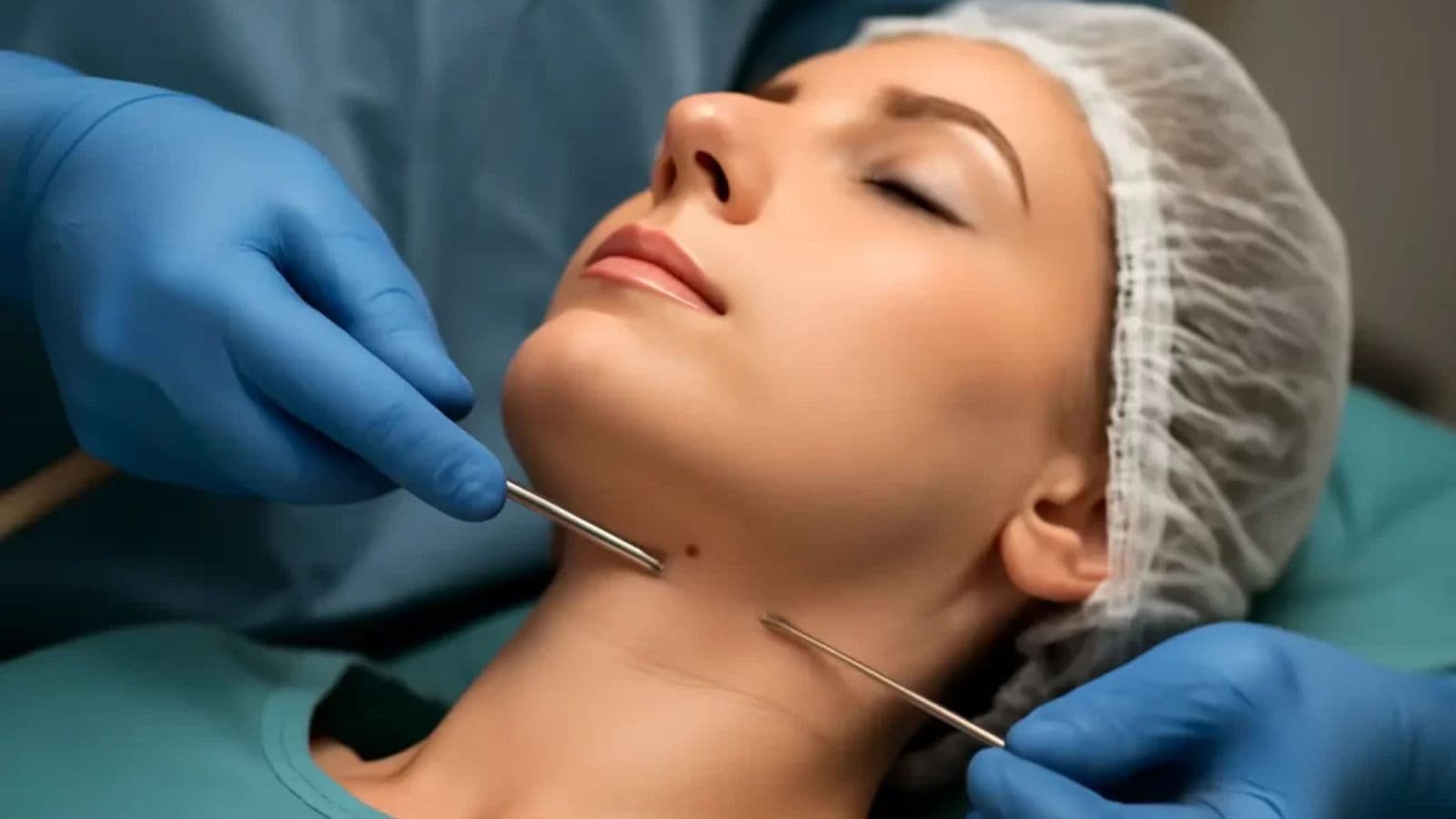 Double Chin | FK Clinic