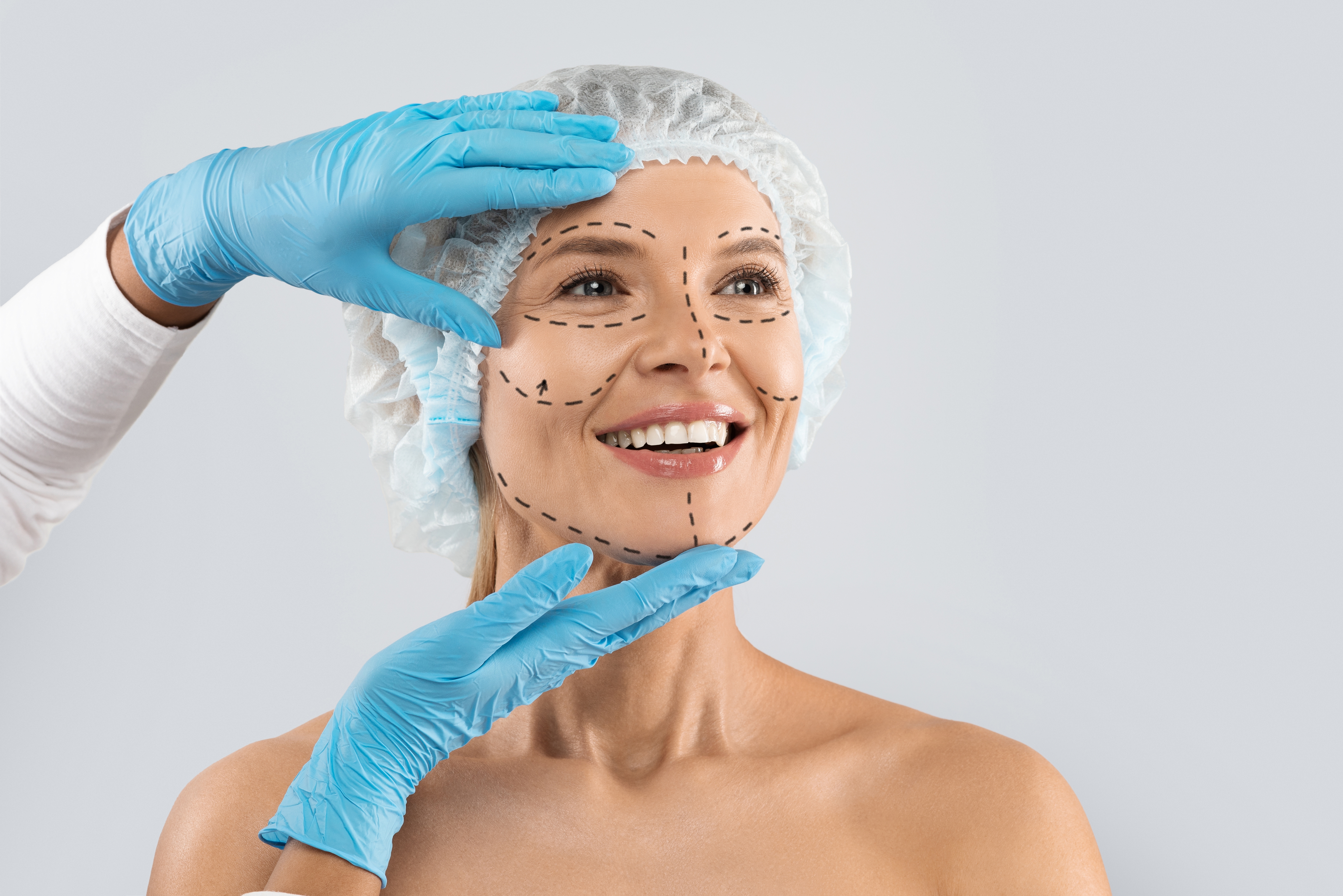 Facial Rejuvenation Results
